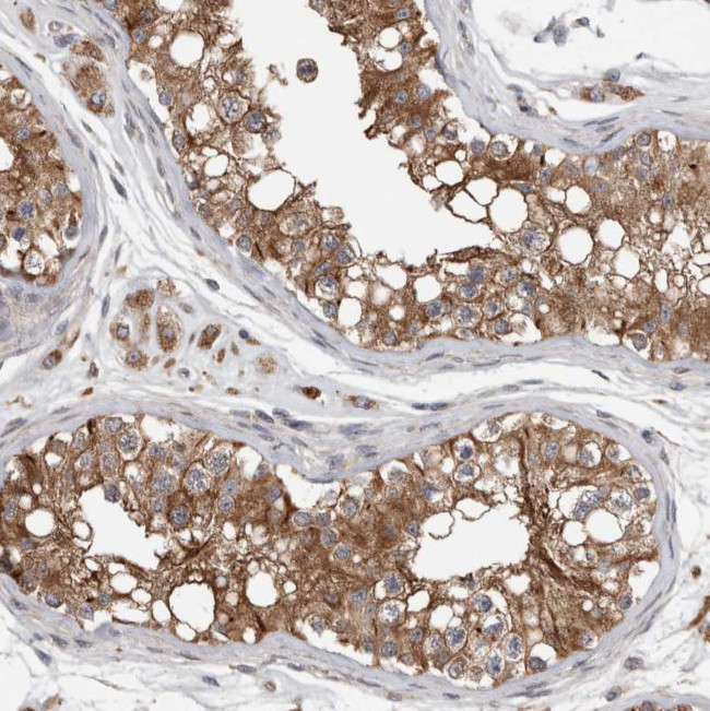 LPHN3 Antibody in Immunohistochemistry (Paraffin) (IHC (P))