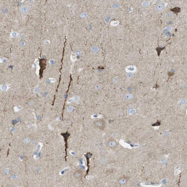 PTPRZ Antibody in Immunohistochemistry (IHC)