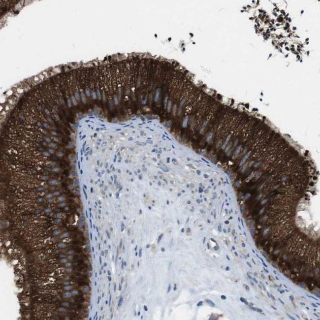 UGGT1 Antibody in Immunohistochemistry (IHC)