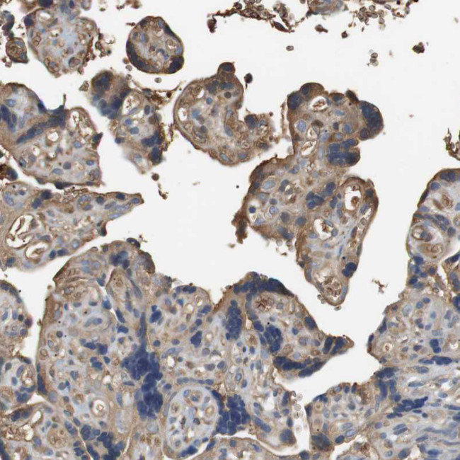 ADCY10 Antibody in Immunohistochemistry (Paraffin) (IHC (P))