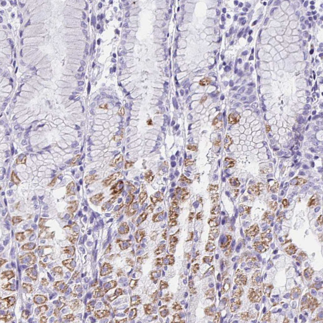 Aquaporin 6 Antibody in Immunohistochemistry (Paraffin) (IHC (P))