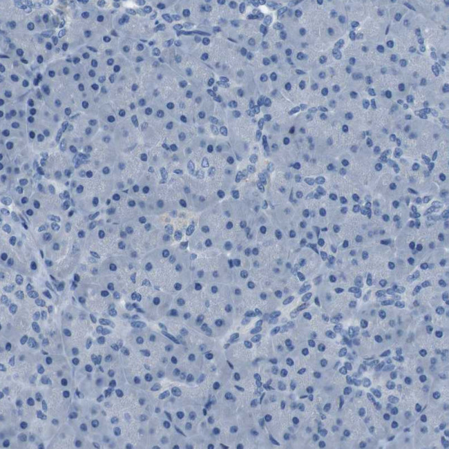 TULP3 Antibody in Immunohistochemistry (Paraffin) (IHC (P))