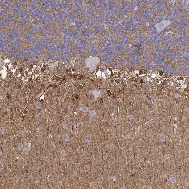 NDRG4 Antibody in Immunohistochemistry (IHC)