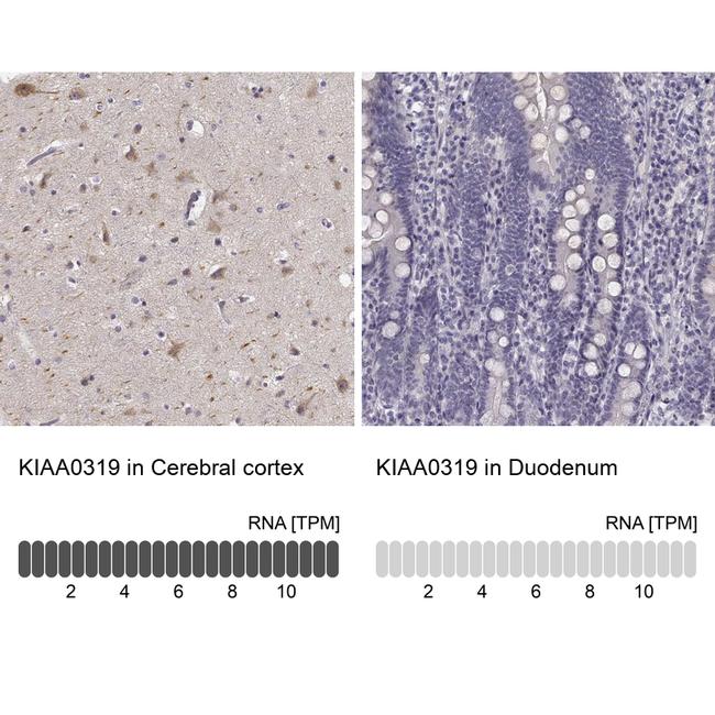 Kiaa0319 Antibody in Immunohistochemistry (IHC)