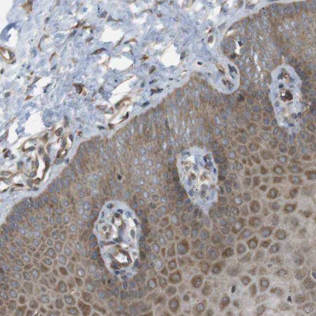 KANK2 Antibody in Immunohistochemistry (Paraffin) (IHC (P))