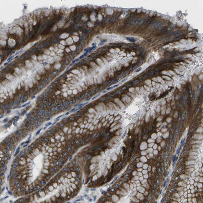 GDF5 Antibody in Immunohistochemistry (Paraffin) (IHC (P))