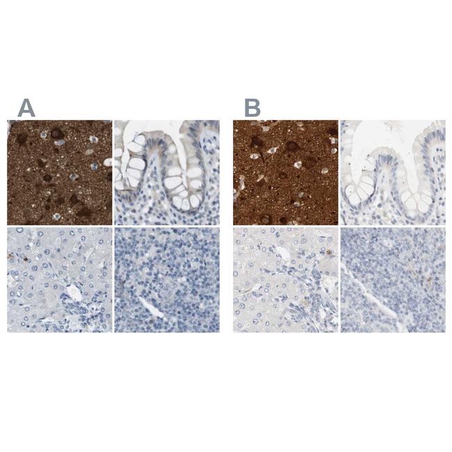 RTN3 Antibody in Immunohistochemistry (IHC)