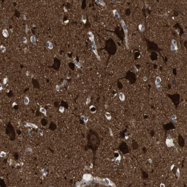 DCLK1 Antibody in Immunohistochemistry (Paraffin) (IHC (P))