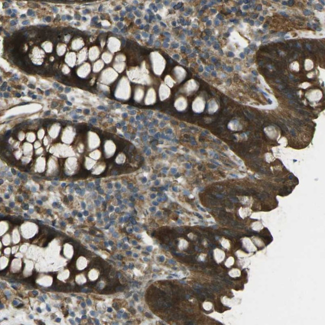 CHMP3 Antibody in Immunohistochemistry (Paraffin) (IHC (P))