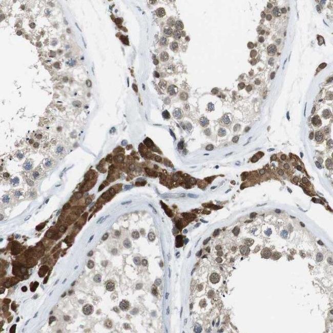 NEK4 Antibody in Immunohistochemistry (IHC)