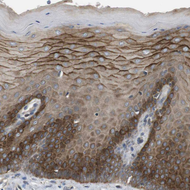 LPHN3 Antibody in Immunohistochemistry (Paraffin) (IHC (P))