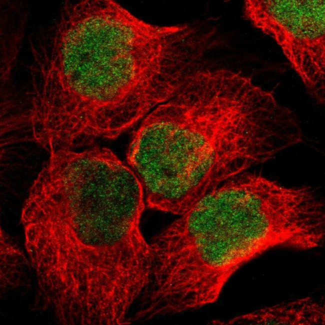 NSD2 Antibody in Immunocytochemistry (ICC/IF)