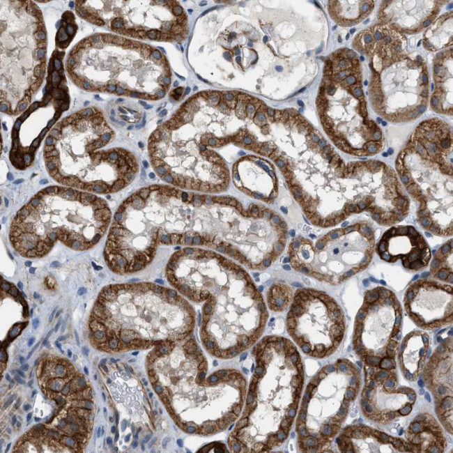 PCLO Antibody in Immunohistochemistry (Paraffin) (IHC (P))