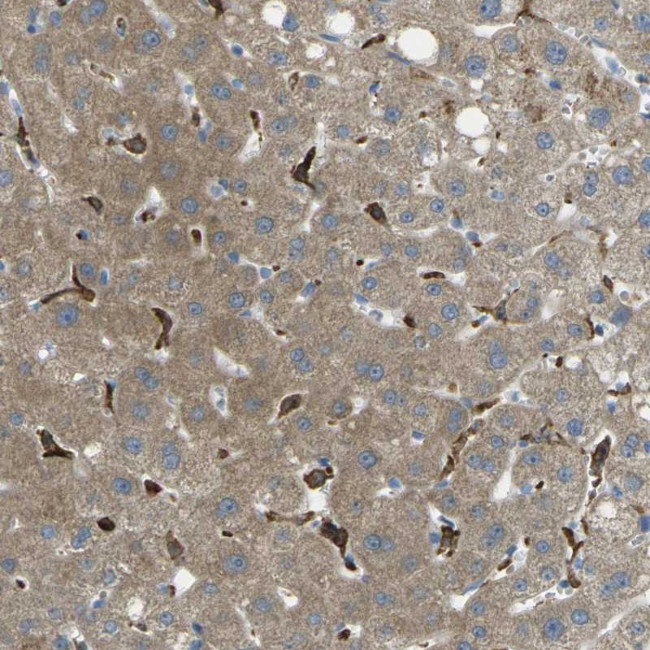 MYLK4 Antibody in Immunohistochemistry (Paraffin) (IHC (P))