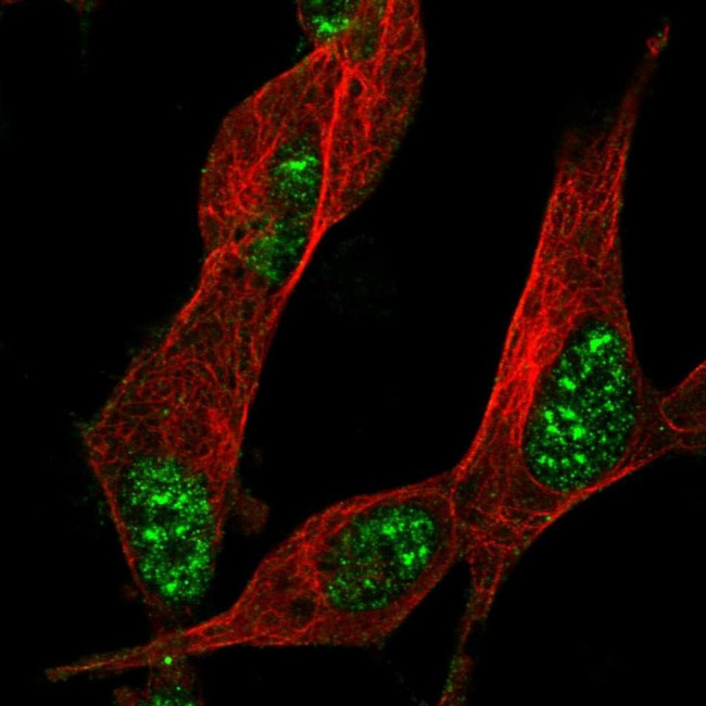 ZNF179 Antibody in Immunocytochemistry (ICC/IF)