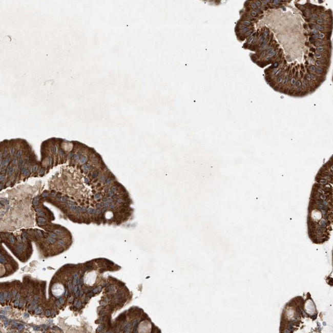 MTCH1 Antibody in Immunohistochemistry (Paraffin) (IHC (P))