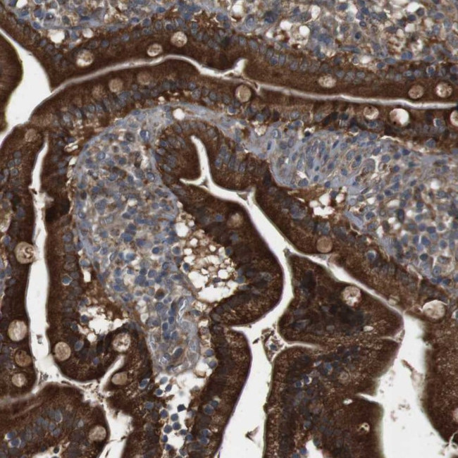 IFFO2 Antibody in Immunohistochemistry (Paraffin) (IHC (P))