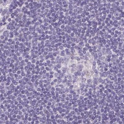 ASGR2 Antibody in Immunohistochemistry (Paraffin) (IHC (P))