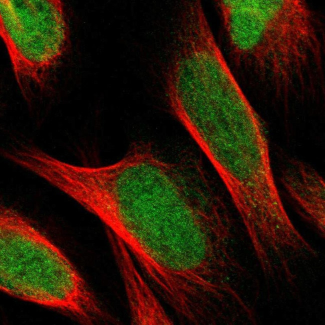 EVC Antibody in Immunocytochemistry (ICC/IF)