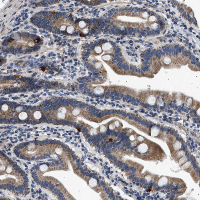 KV1.4 (KCNA4) Antibody in Immunohistochemistry (Paraffin) (IHC (P))