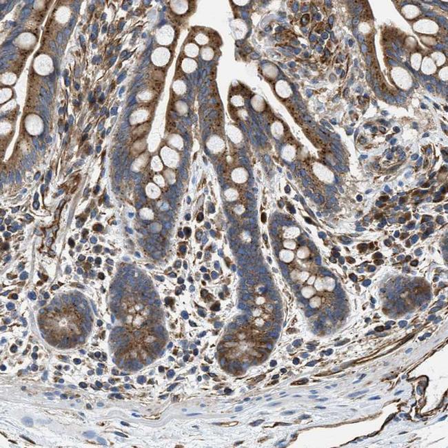 HSD17B12 Antibody in Immunohistochemistry (IHC)