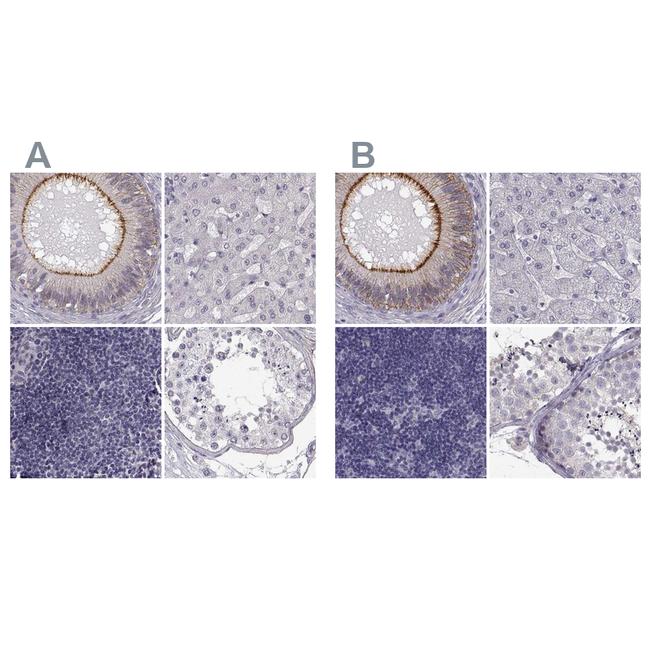 ZNF185 Antibody in Immunohistochemistry (IHC)