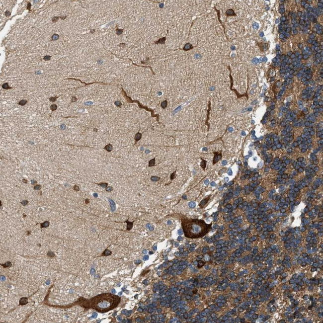 KDELR2 Antibody in Immunohistochemistry (Paraffin) (IHC (P))