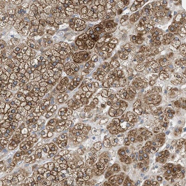 AGPAT6 Antibody in Immunohistochemistry (IHC)