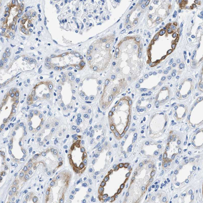 Bisphosphoglycerate mutase Antibody in Immunohistochemistry (Paraffin) (IHC (P))