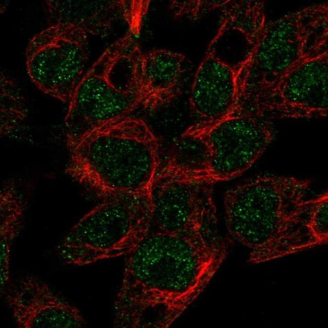 ABCG5 Antibody in Immunocytochemistry (ICC/IF)