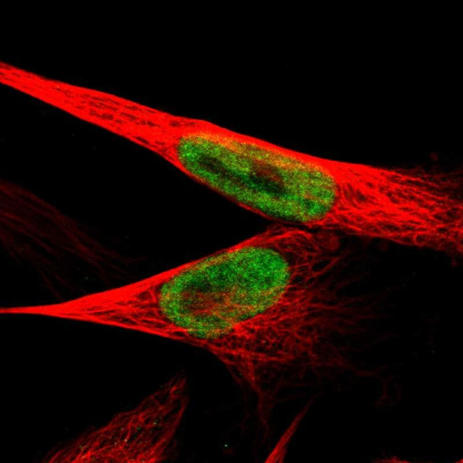 JMJD1B Antibody in Immunocytochemistry (ICC/IF)