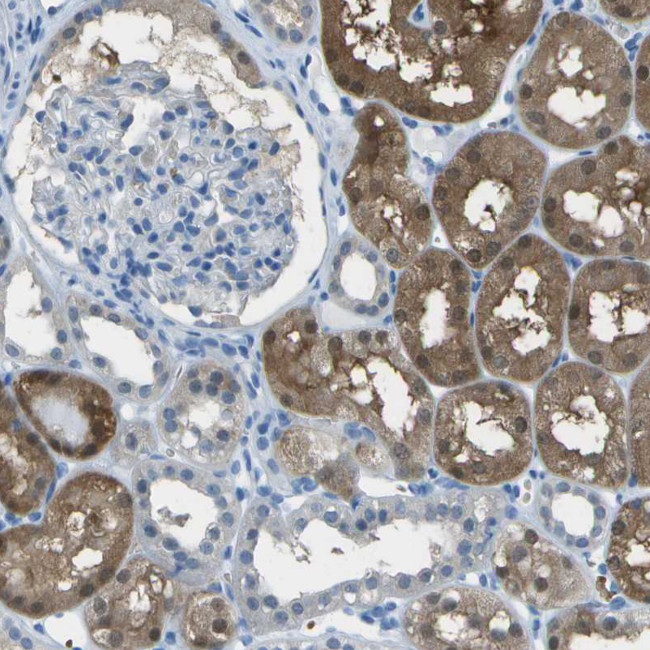 ASL Antibody in Immunohistochemistry (Paraffin) (IHC (P))