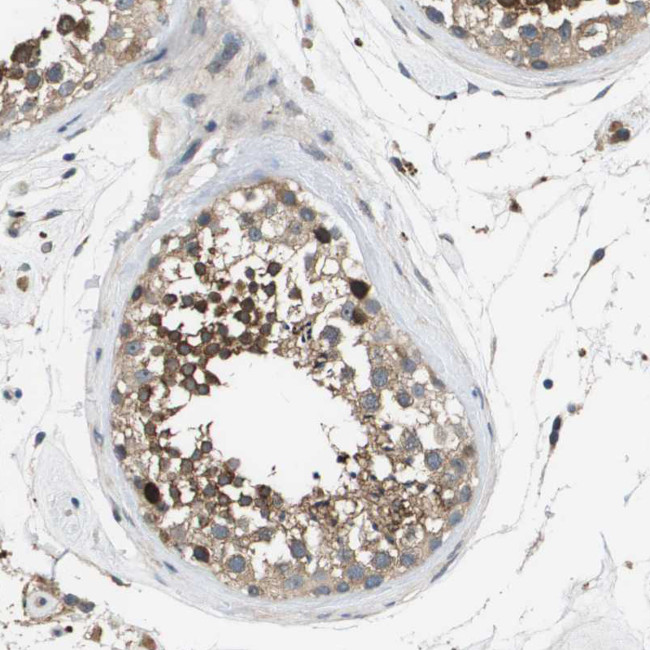 SLC25A20 Antibody in Immunohistochemistry (Paraffin) (IHC (P))