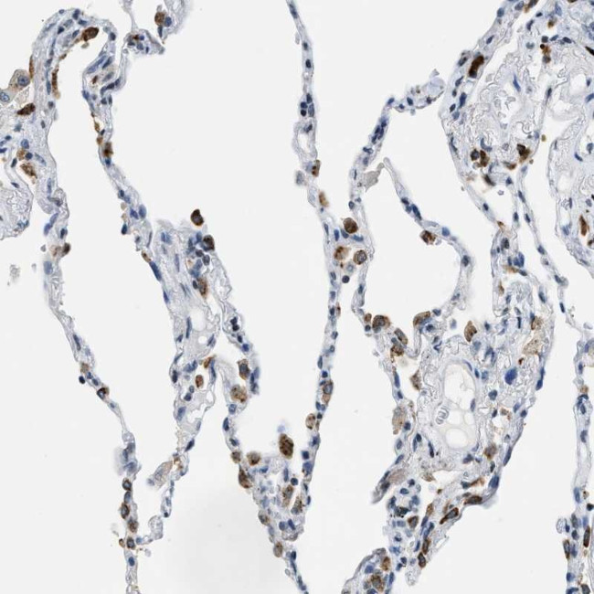 UVRAG Antibody in Immunohistochemistry (Paraffin) (IHC (P))