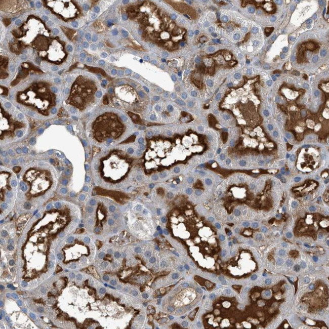 ATP6V0D1 Antibody in Immunohistochemistry (Paraffin) (IHC (P))