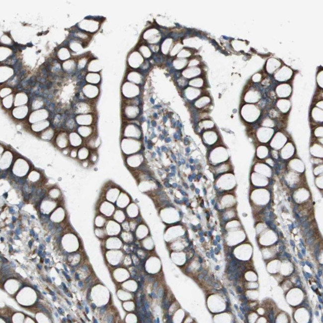 UTS2 Antibody in Immunohistochemistry (Paraffin) (IHC (P))