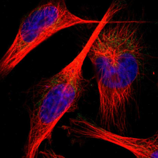 PNKD Antibody in Immunocytochemistry (ICC/IF)