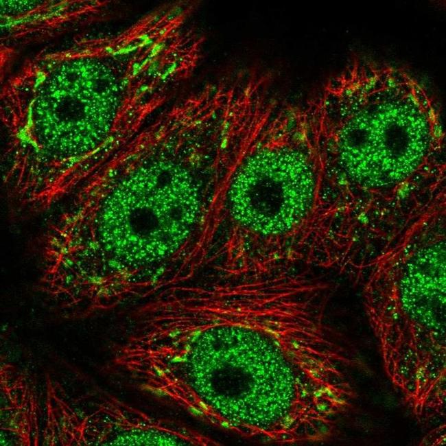 GALNT6 Antibody in Immunocytochemistry (ICC/IF)