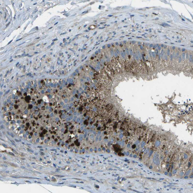 ACPL2 Antibody in Immunohistochemistry (Paraffin) (IHC (P))