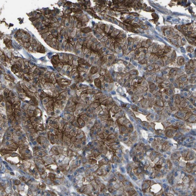 CYP4F11 Antibody in Immunohistochemistry (Paraffin) (IHC (P))