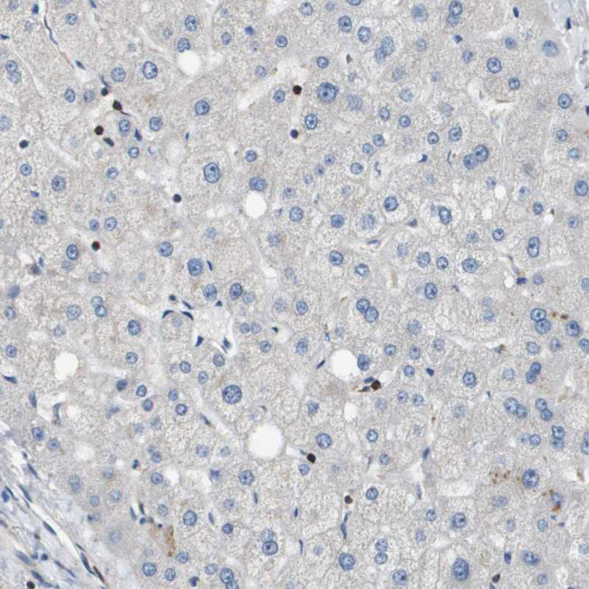 SCN4B Antibody in Immunohistochemistry (Paraffin) (IHC (P))