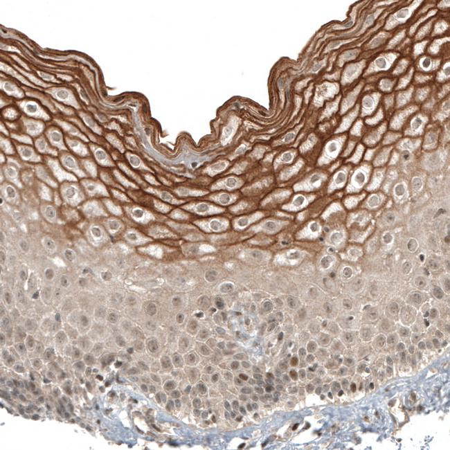 IFNLR1 Antibody in Immunohistochemistry (IHC)