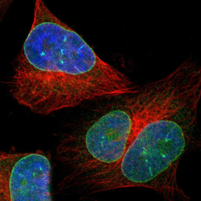 LEMD2 Antibody in Immunocytochemistry (ICC/IF)