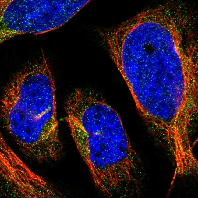 HLCS Antibody in Immunocytochemistry (ICC/IF)