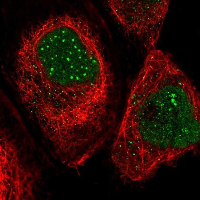 SP100 Antibody in Immunocytochemistry (ICC/IF)