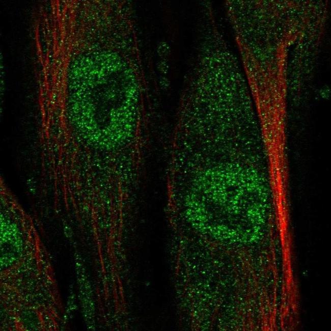 NAALADL2 Antibody in Immunocytochemistry (ICC/IF)