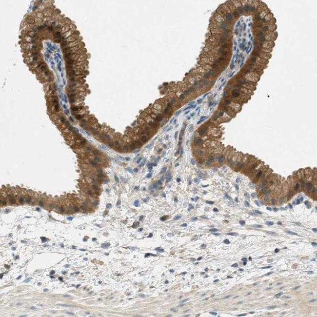 NUDT4 Antibody in Immunohistochemistry (IHC)