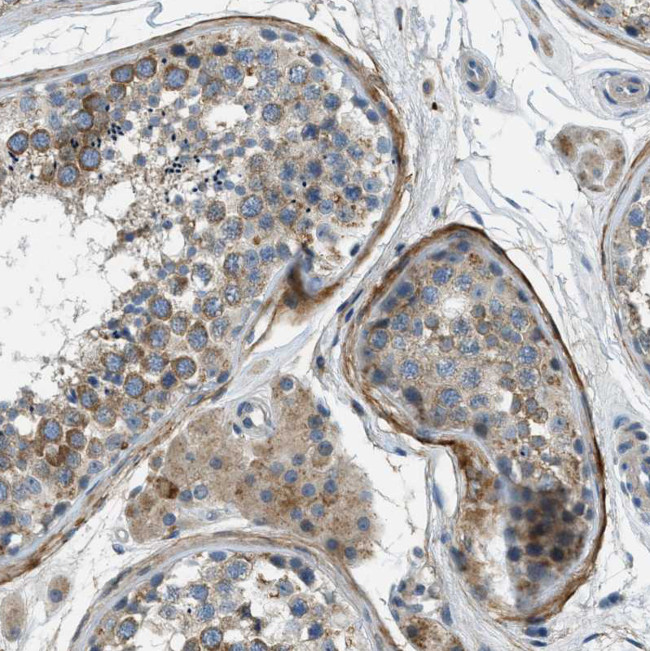 SNX14 Antibody in Immunohistochemistry (Paraffin) (IHC (P))