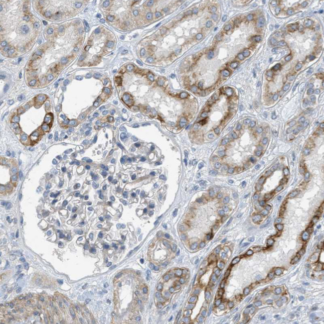 MRS2 Antibody in Immunohistochemistry (Paraffin) (IHC (P))