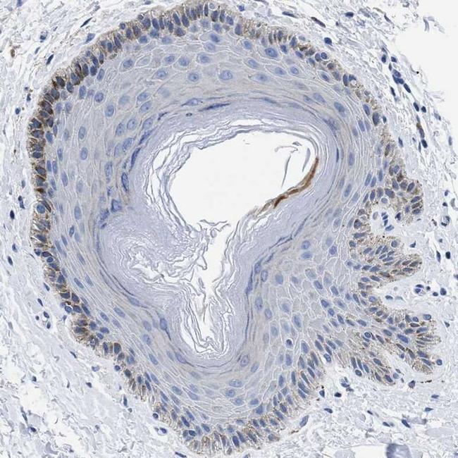 PRSS16 Antibody in Immunohistochemistry (IHC)